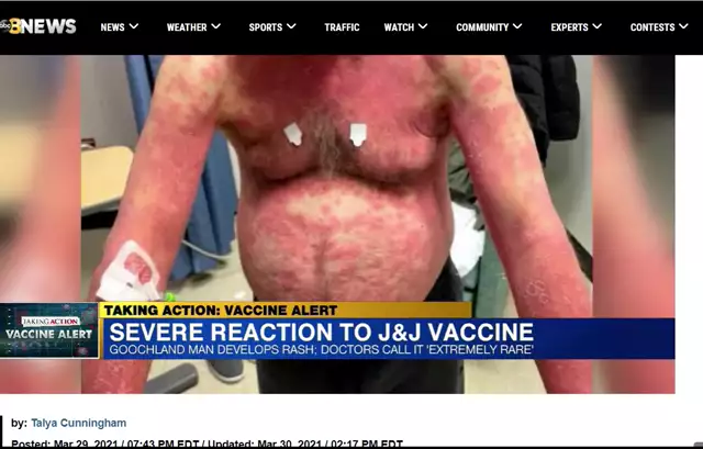 Man has severe reaction to Johnson and Johnson vax VCU doctors believe it was direct result of shot(כתוביות אוטו)