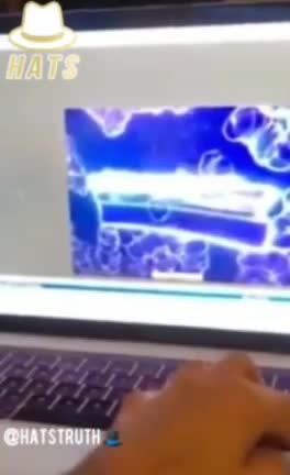 דר' פגי מראה את ההבדל בין דם נורמאלי לדם של מוזרקי פייזר ומודרנה