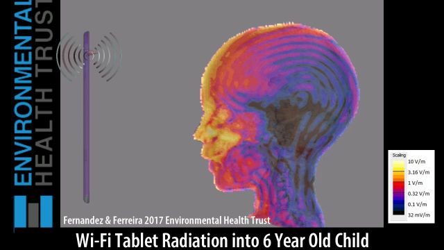 Wi-Fi Tablet Radiation into 6 Year old Child Brain