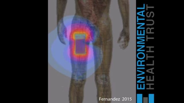 Mobile Phone in Pocket Exposes Reproductive Organs to Radiation