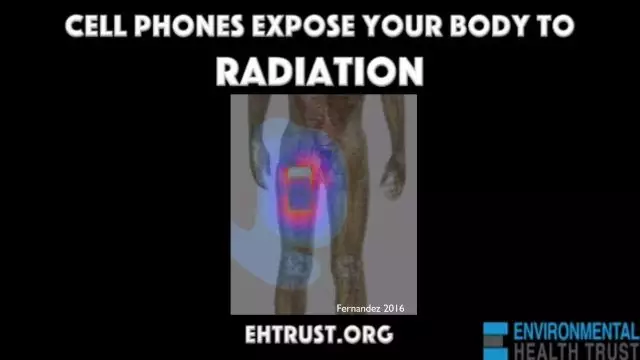 Cell Phones in the Pants Expose your Body To Microwaves