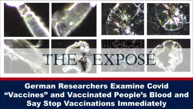German Researchers Examine Covid VAX and Vaccinated People s Blood and Say Stop Vaccinations (15-8-2022)