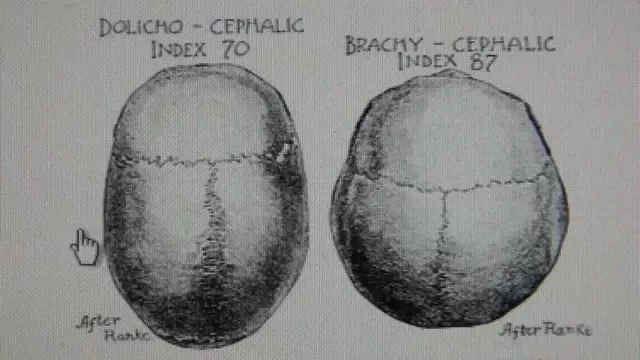 Swiss have Khazarian Brachycephalic Craniometry Cephalometry from Central Asia Mongolia