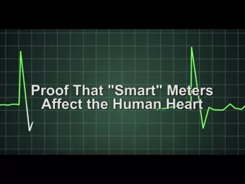 EKG Proof That ''Smart'' Meters Affect the Human Heart