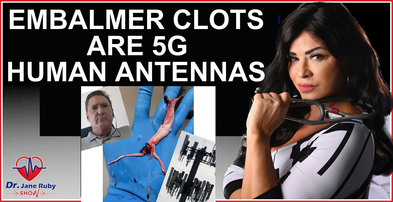 BOMBSHELL:  PROOF EMBALMER CLOTS ARE 5G CONTROLLED HUMAN ANTENNAS