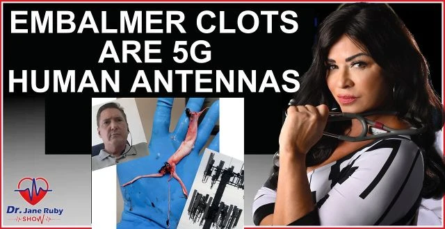 BOMBSHELL:  PROOF EMBALMER CLOTS ARE 5G CONTROLLED HUMAN ANTENNAS